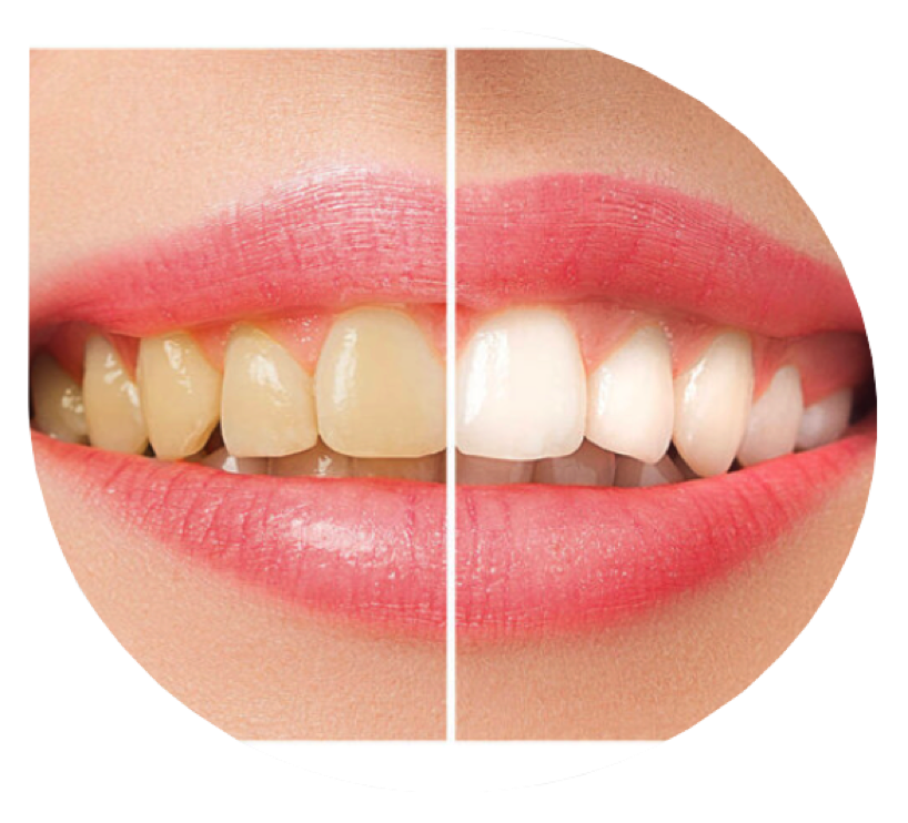 Dra.DannaK Your Best Choice in Dential Aesthetics!!